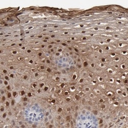 SLC6A14 Antibody, Novus Biologicals:Antibodies:Primary Antibodies